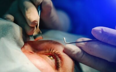 CMAJ study showing lower income people have less access to for-profit cataract surgeries must force a reconsideration of policy, says hospital union